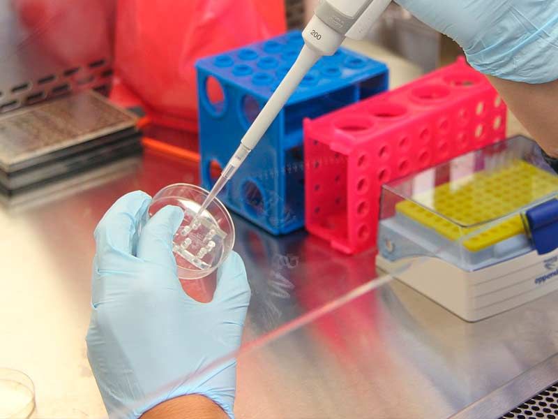 Control de legionela Control de legionela